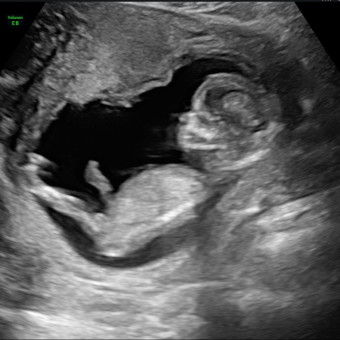 Babylist Registry Photo.