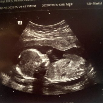 Babylist Registry Photo.