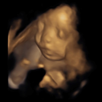 Babylist Registry Photo.