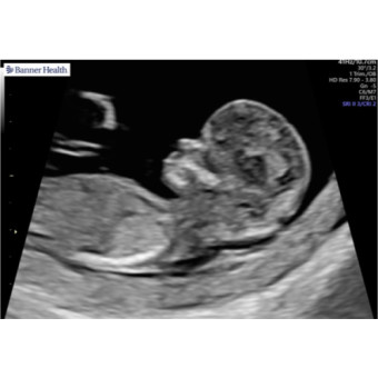 Babylist Registry Photo.