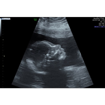 Babylist Registry Photo.