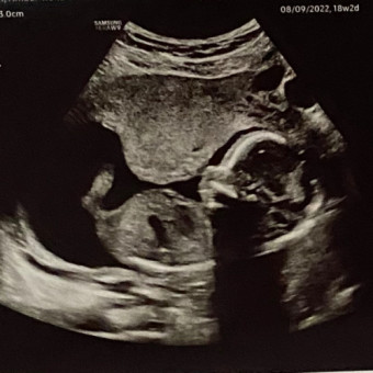 Babylist Registry Photo.
