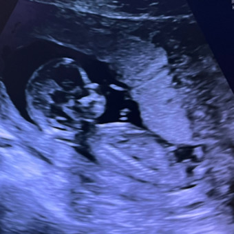 Babylist Registry Photo.