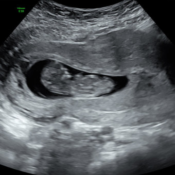 Babylist Registry Photo.