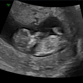 Babylist Registry Photo.