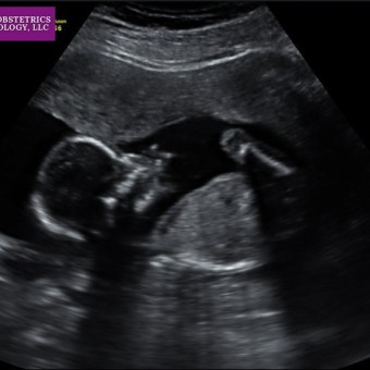 Babylist Registry Photo.