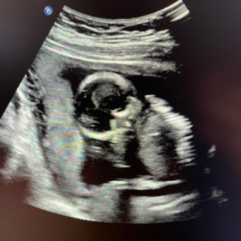 Babylist Registry Photo.