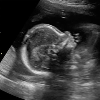 Babylist Registry Photo.