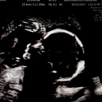 Melissa And Rafael Orsi S Baby Registry At Babylist