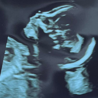Babylist Registry Photo.