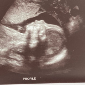 Babylist Registry Photo.