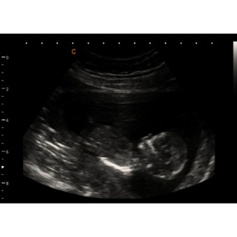 Babylist Registry Photo.