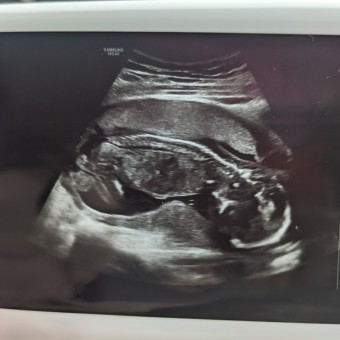 Babylist Registry Photo.