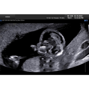 Babylist Registry Photo.