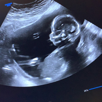 Babylist Registry Photo.
