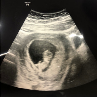 Babylist Registry Photo.