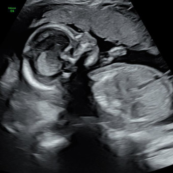 Babylist Registry Photo.