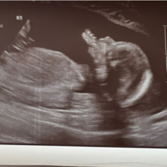Babylist Registry Photo.