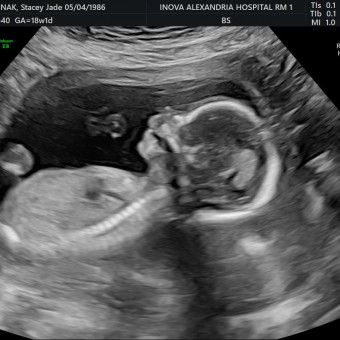 Babylist Registry Photo.
