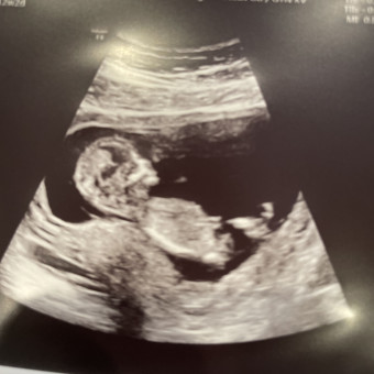 Babylist Registry Photo.