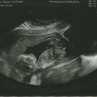 Babylist Registry Photo.