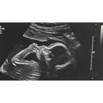 Babylist Registry Photo.