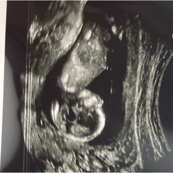 Babylist Registry Photo.