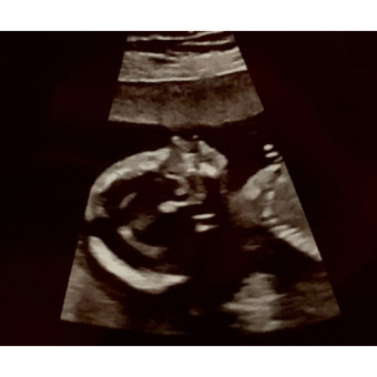 Babylist Registry Photo.
