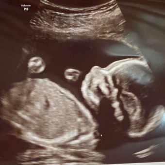 Babylist Registry Photo.