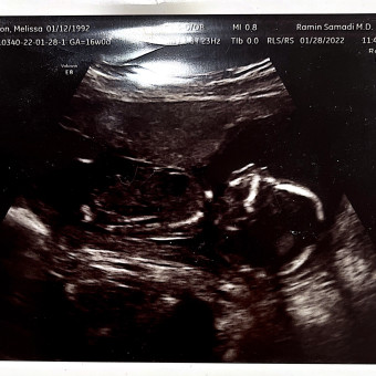 Babylist Registry Photo.