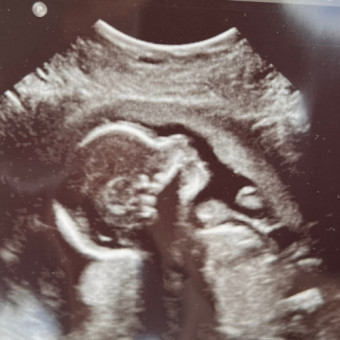 Babylist Registry Photo.