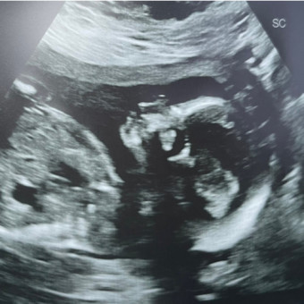Babylist Registry Photo.