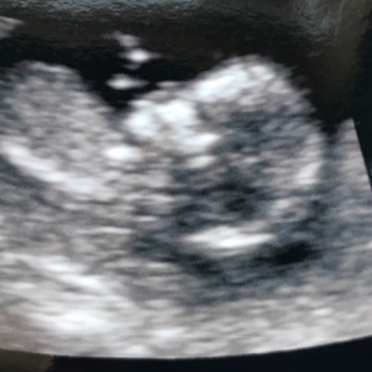 Babylist Registry Photo.