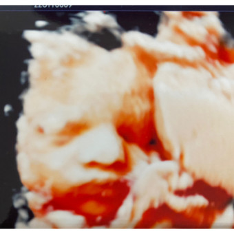 Babylist Registry Photo.