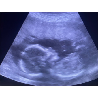 Babylist Registry Photo.