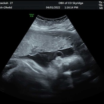 Babylist Registry Photo.