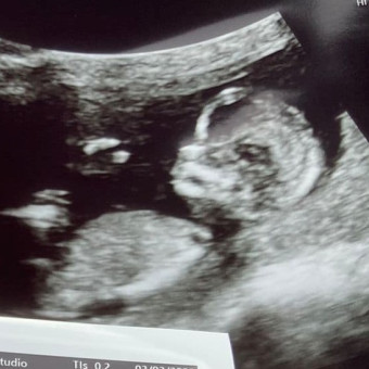 Babylist Registry Photo.