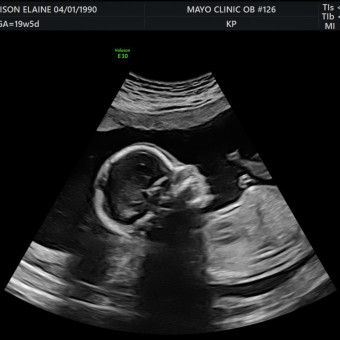 Babylist Registry Photo.