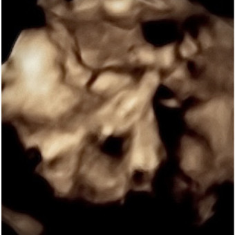 Babylist Registry Photo.