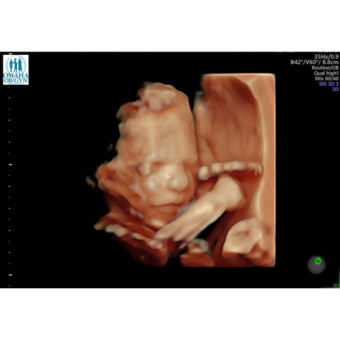 Babylist Registry Photo.