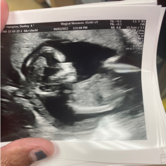 Babylist Registry Photo.