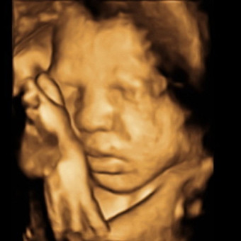 Babylist Registry Photo.