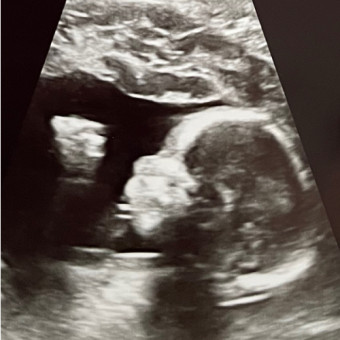 Babylist Registry Photo.