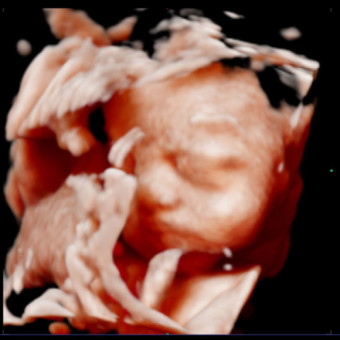 Babylist Registry Photo.