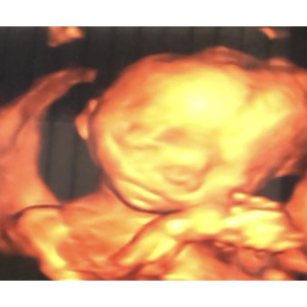 Babylist Registry Photo.