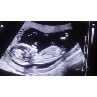 Babylist Registry Photo.