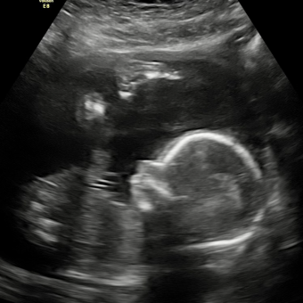 Babylist Registry Photo.