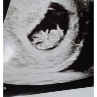 Babylist Registry Photo.