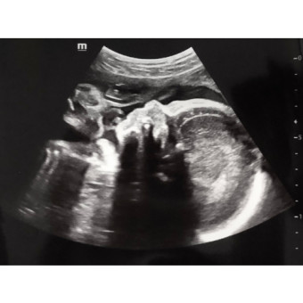 Babylist Registry Photo.