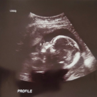 Babylist Registry Photo.